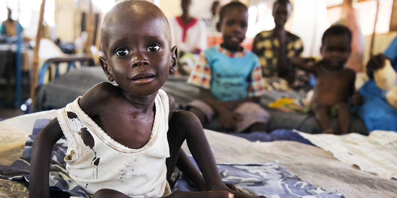 BM: Dünya harekete geçmezse Doğu Afrika'da çocuk ölümlerinde büyük artış olur