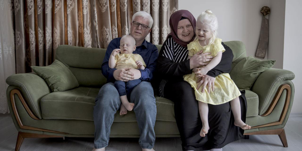 Öğretmen ve müezzin çift ile iki çocuklarının albinizm ile imtihanı