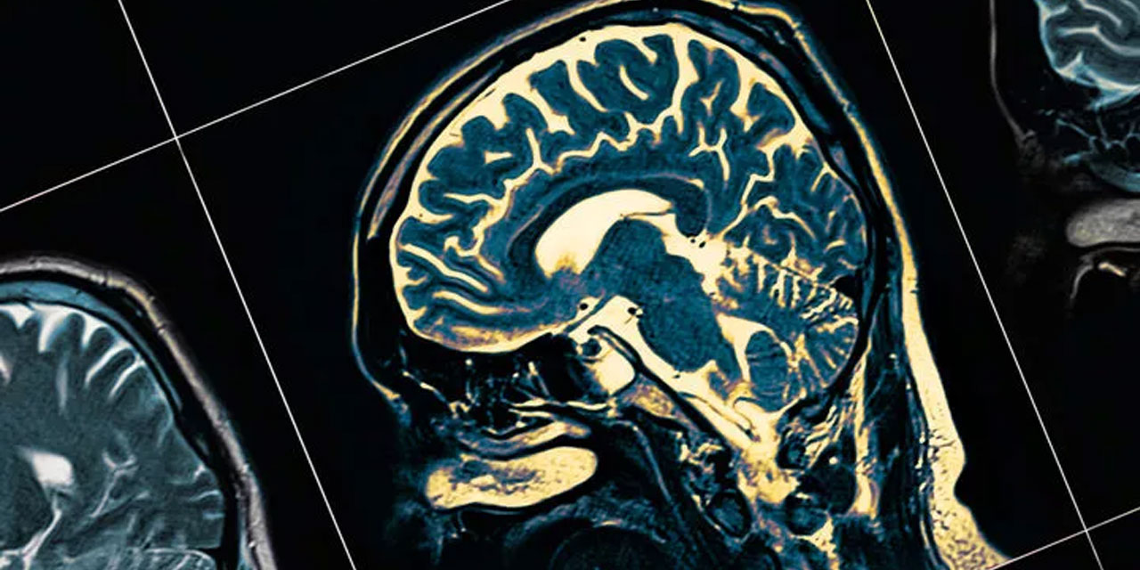 İlk kez bir insan beyni ölüme geçiş sırasında kaydedildi