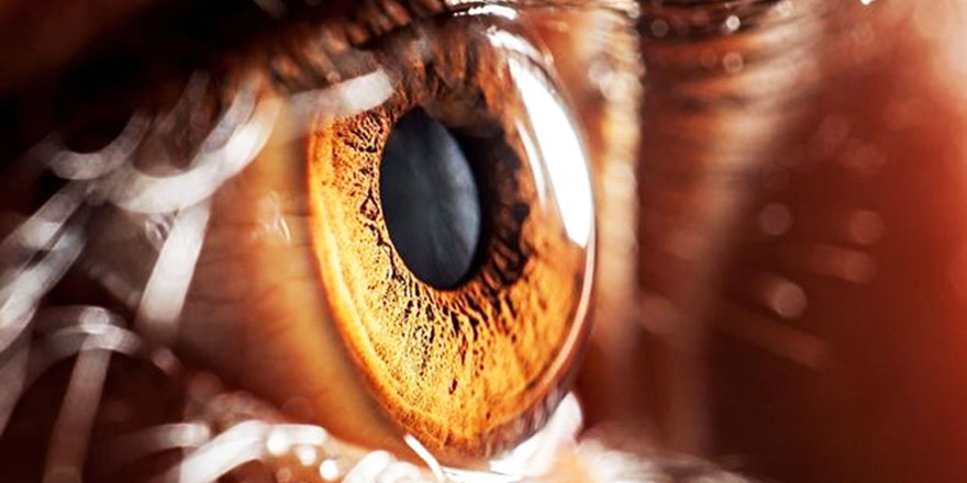 Göz tansiyonunda geç tanı kalıcı görme kaybına neden olabiliyor