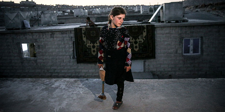 Esed'in bombalarıyla bacağını kaybeden Yasemin'in hayali